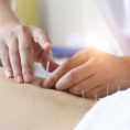 Closeup of a person putting acupuncture needles into another person's back