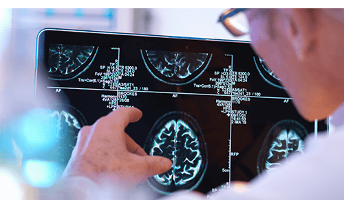 Doctor reviewing a brain scan