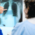 Doctor showing lung x-ray to patient