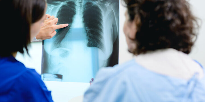Doctor showing lung x-ray to patient